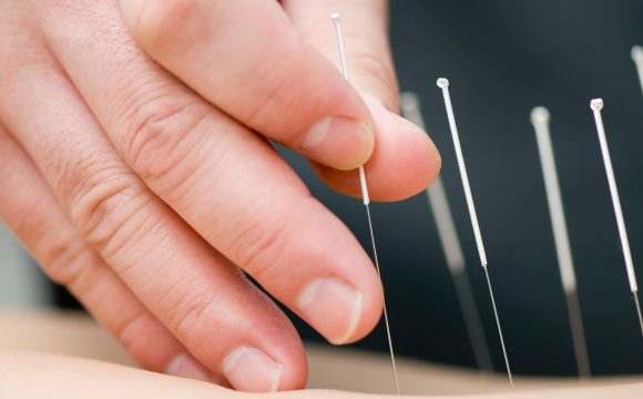 Acupuntura